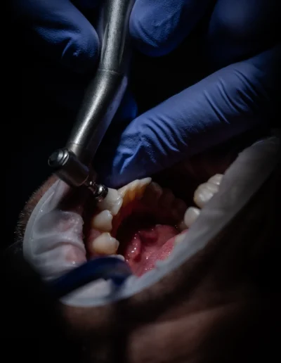 Dottor Michele Boglioni che lavora sui denti di un paziente