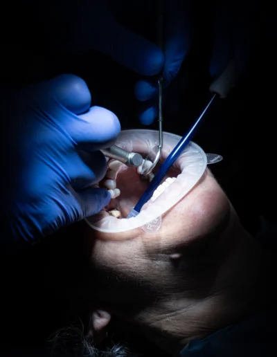 Dottore che passa una fresa su un dente di un paziente