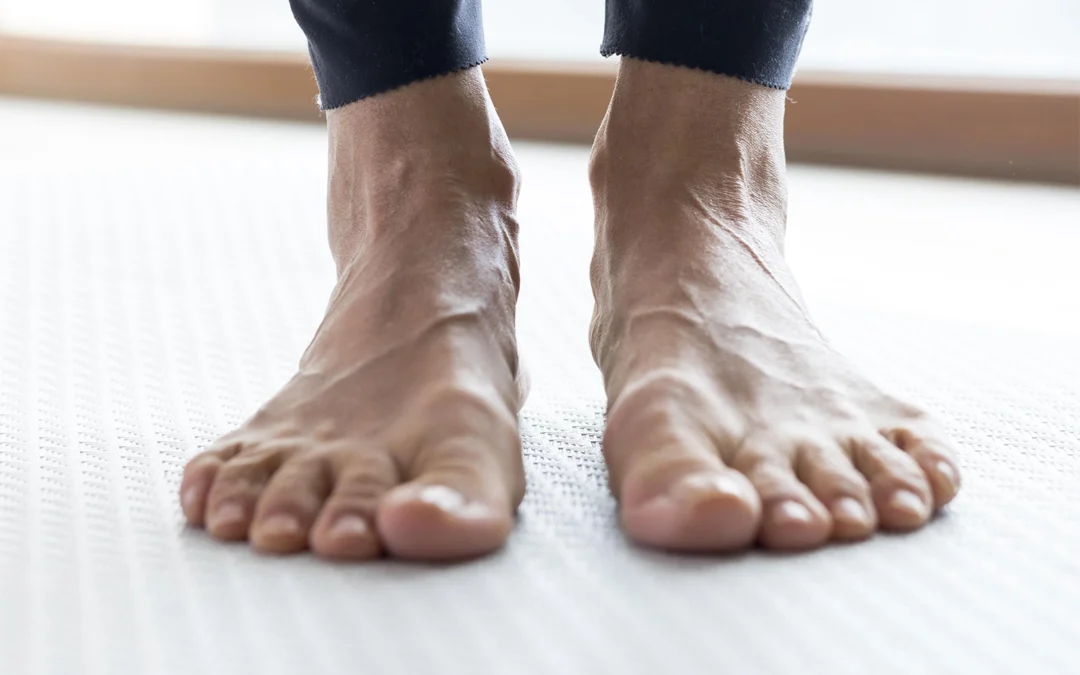 Piede Piatto: Cause, Sintomi e Soluzioni per il Benessere dei Tuoi Piedi