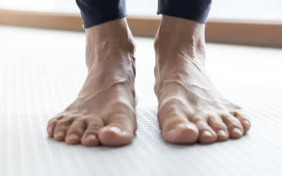 Piede Piatto: Cause, Sintomi e Soluzioni per il Benessere dei Tuoi Piedi