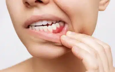 Periodontite: cura e prevenzione a Corte Franca (Brescia)