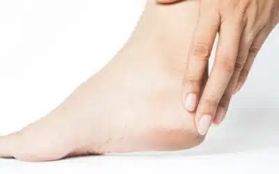 Prevenzione delle callosità e dei duroni