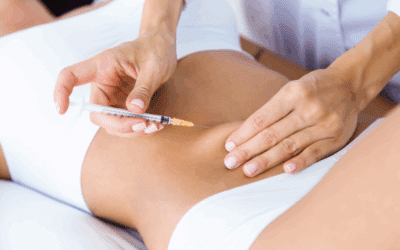 Intralipoterapia: la soluzione efficace per adiposità localizzate