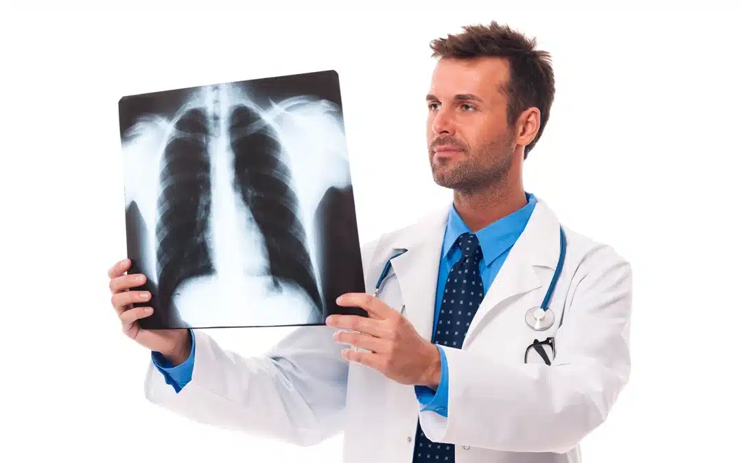 Fibrosi cistica e polipi nasali: cosa c’è da sapere