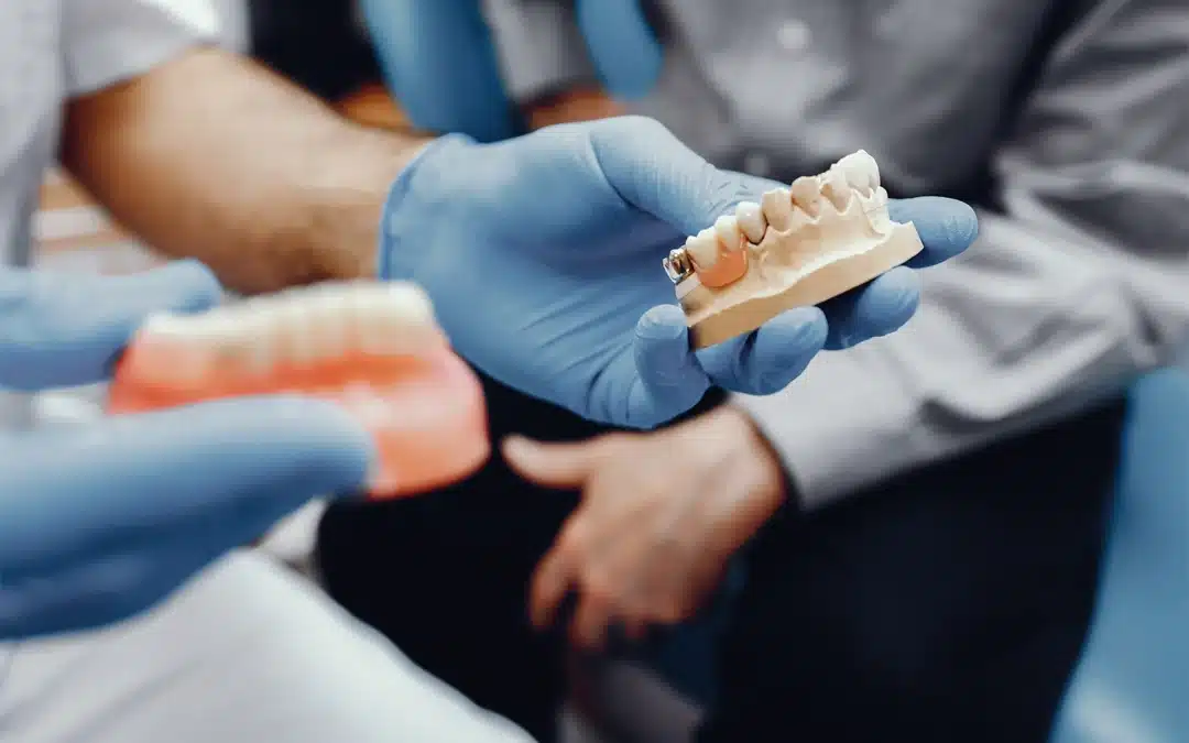 Denti sostitutivi: tutto ciò che devi sapere per scegliere la soluzione migliore