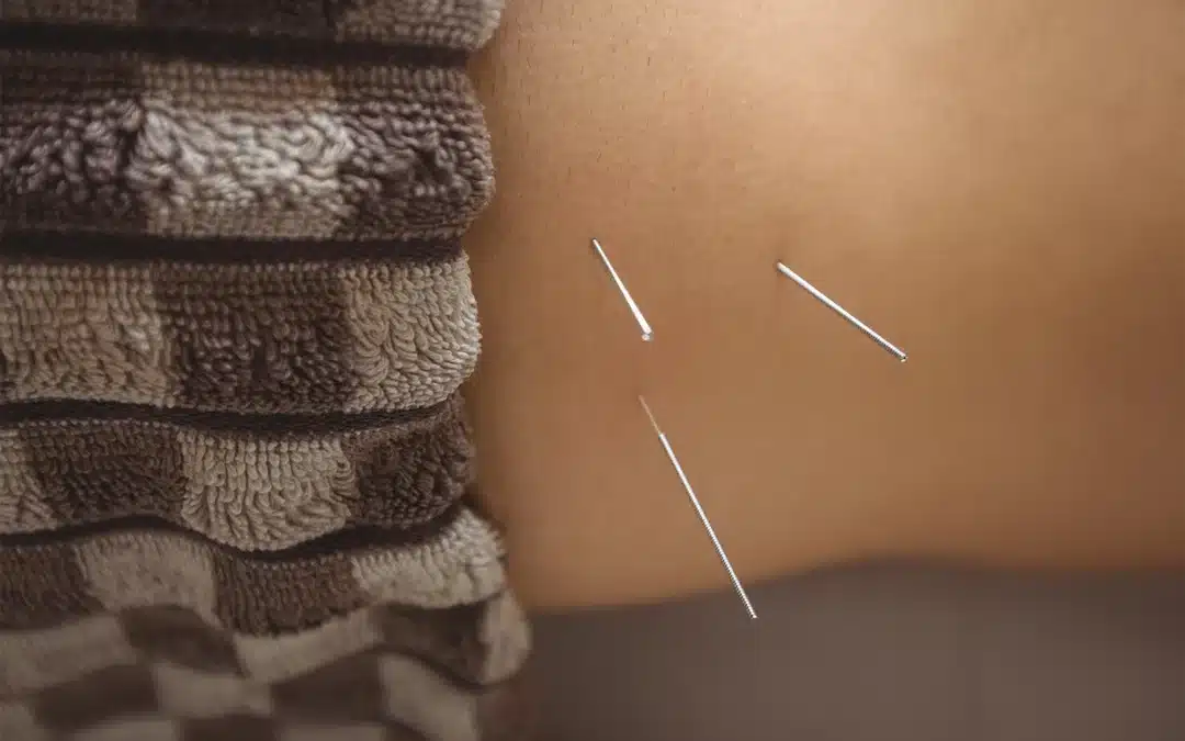 Stress e ansia fuori controllo? L’agopuntura può aiutarti a ritrovare l’equilibrio a Corte Franca (Brescia)